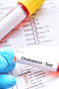 Cholesterol  And Hypothyroidism: What Is The  Connection?